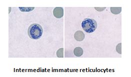 reticulocyte vs heinz body