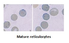 reticulocyte vs heinz body