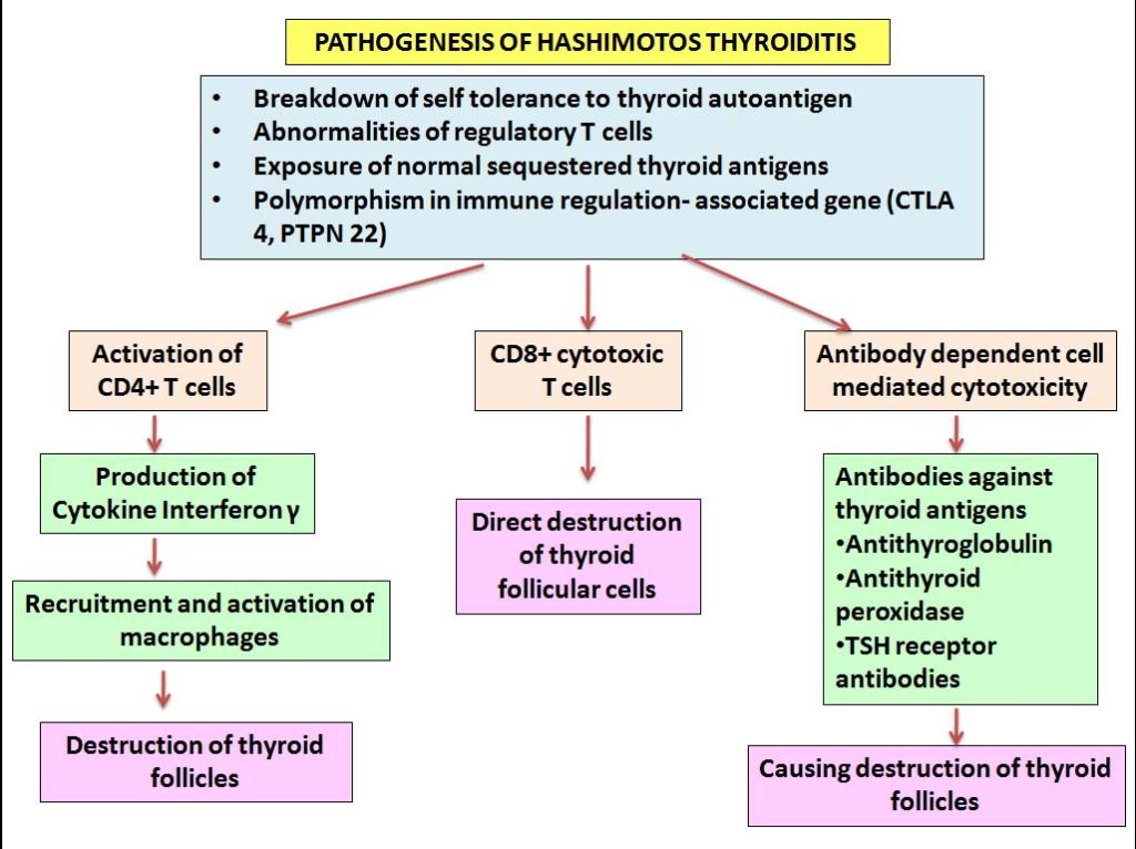 Hashimotos Thyroiditis Histopathologyguru 