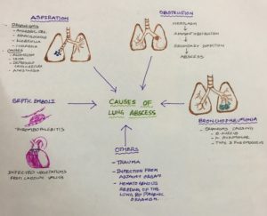 Lung Abscess Ug – Histopathology.guru