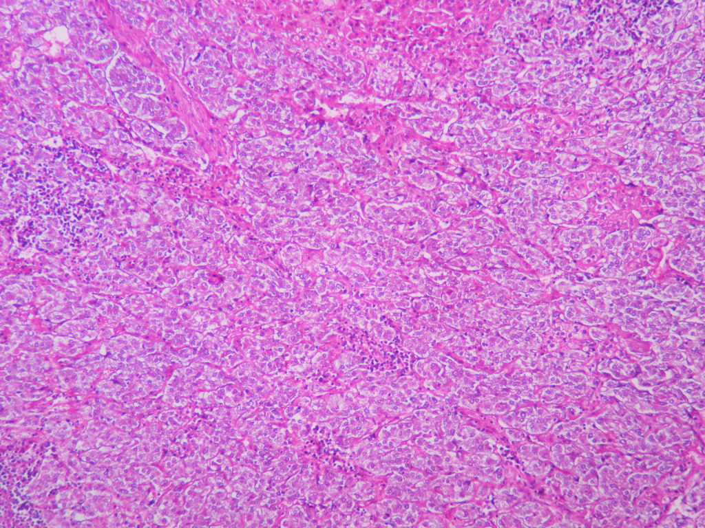 Normal Adrenal – Histopathology.guru