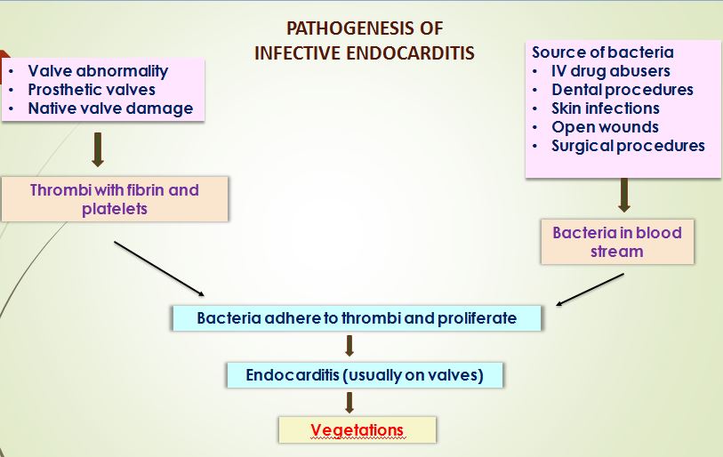 Etiopathogenesis of Infective endocarditis – Histopathology.guru